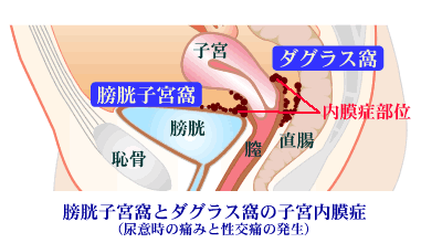 膣 口 痛い